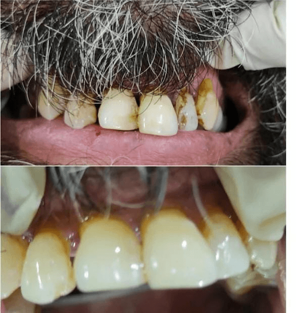 Dental Clinic Environment Patna - 11