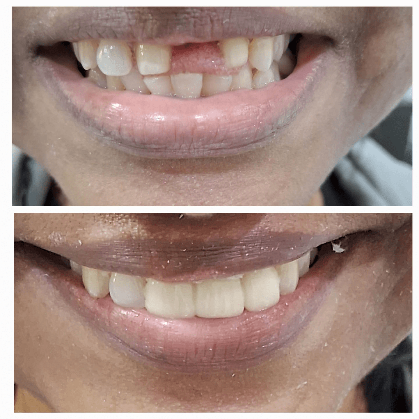 Dental Clinic Environment Patna - 1