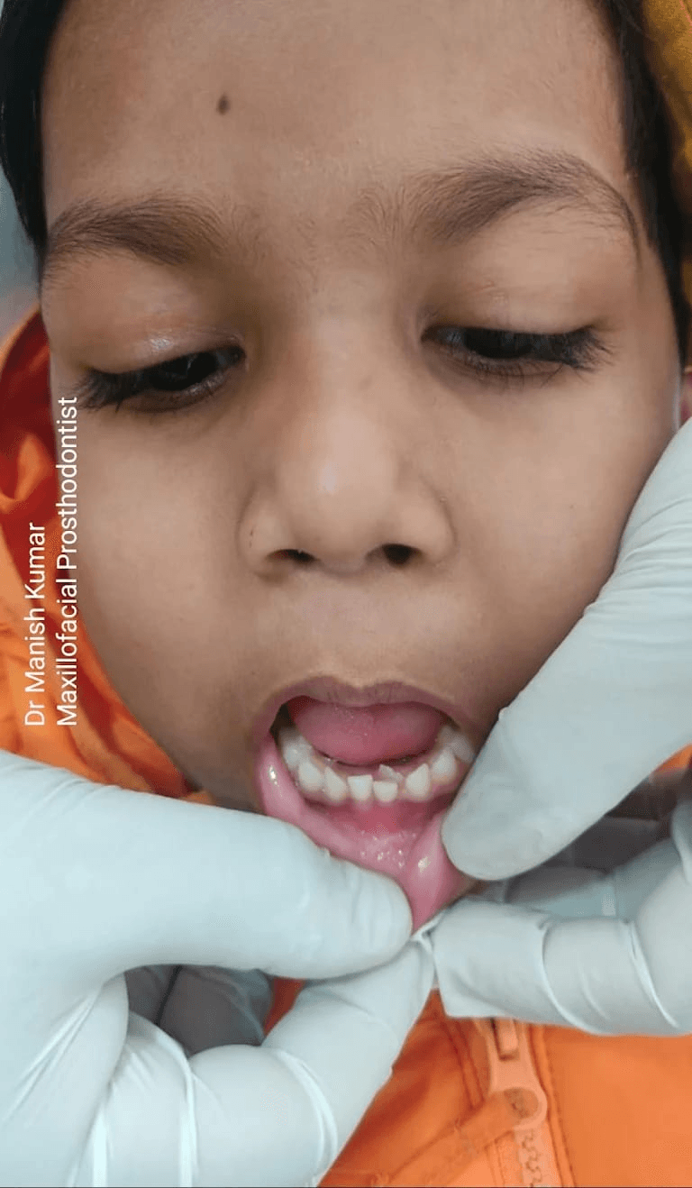 Dental Clinic Environment Patna - 7